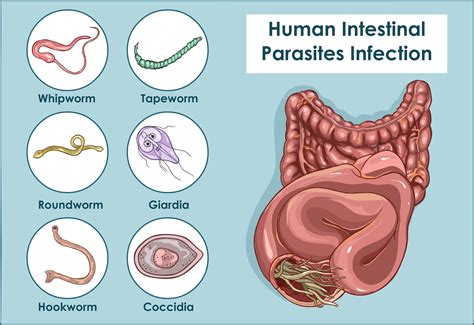 Parasited